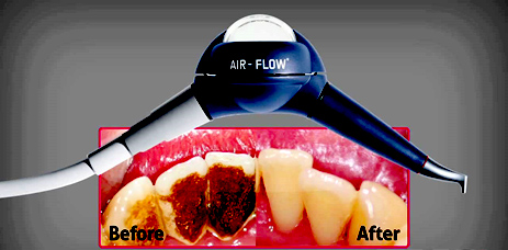 Airflow